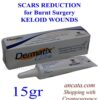 15gr_Dermatix-Ultr_Advanced_Sca_Gel_Solution_for_Surgery_ancata_main